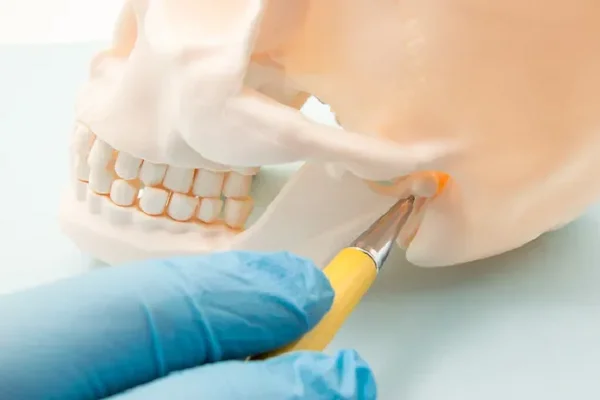 Jaw Fracture Treatment